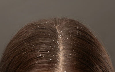 Dandruff ACTIVE Control