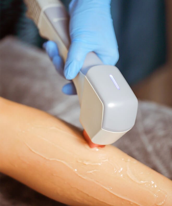 Advanced Laser Hair Removal Southeast Dermatology