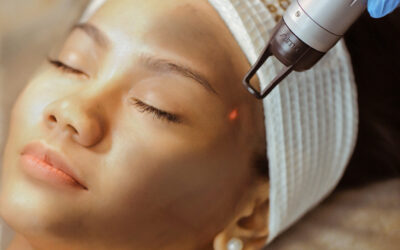 Crystal Carbon Peel Laser