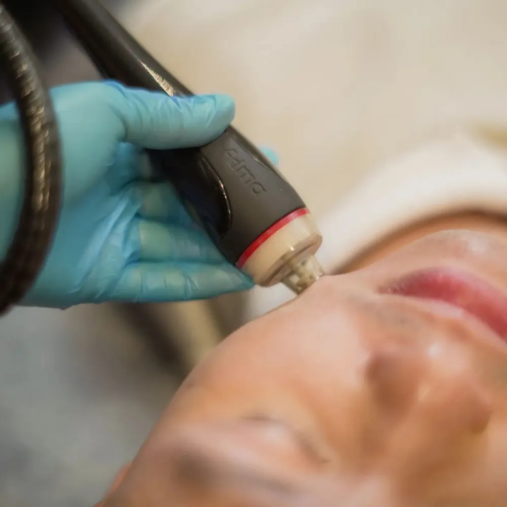 tornado facial